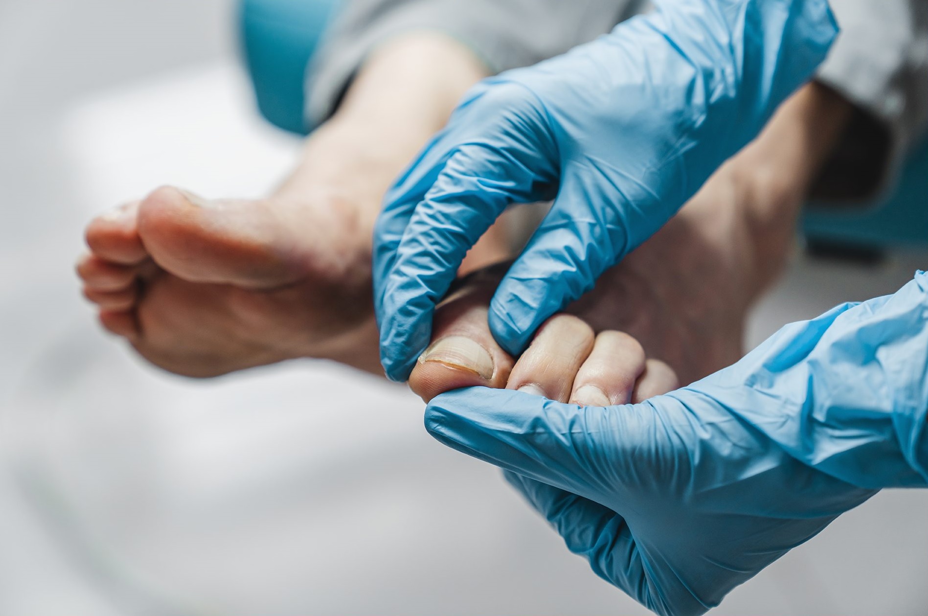 Razlika med estetsko in medicinsko pedikuro: Kaj morate vedeti za zdrava in lepa stopala